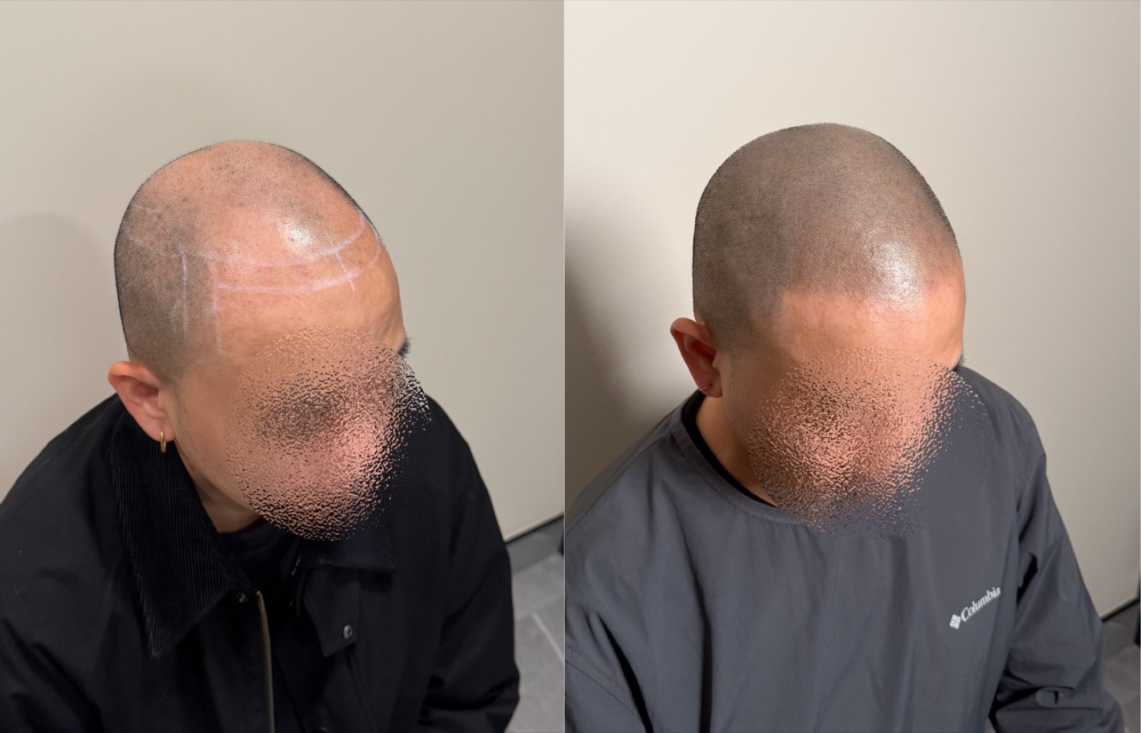Shaved look SMP portfolio 15